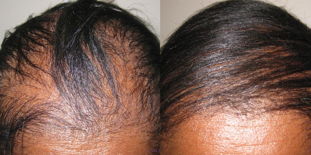 One Serum ๐ 60% Off ๐โSecond Chance to Thrive!